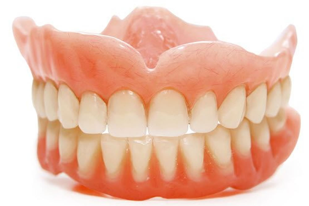 リハビリ義歯